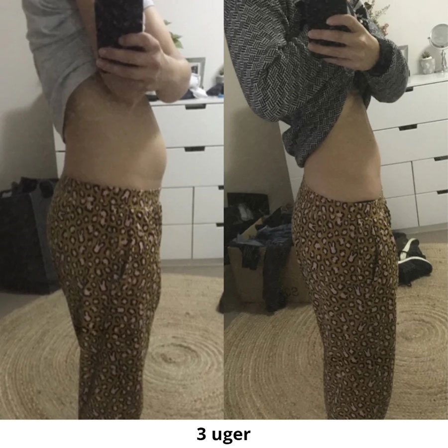 KH-DK-EM-Before-afters1