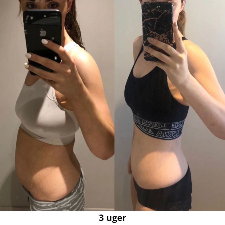 KH-DK-EM-Before-afters2