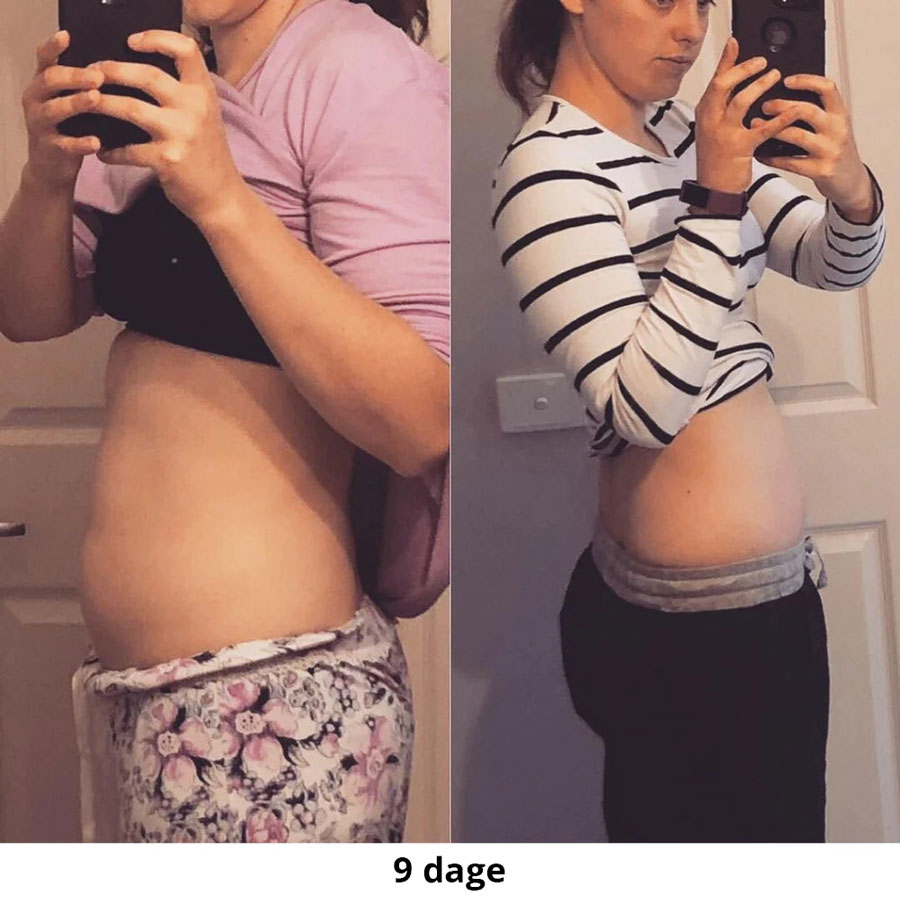 KH-DK-EM-Before-afters3